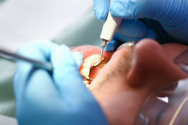 Best Broken or Chipped Tooth Repair in Kaunakakai, HI